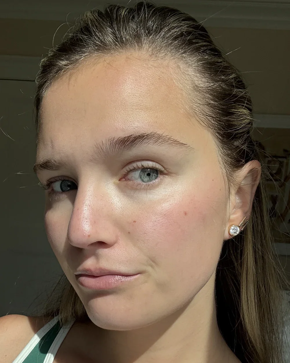 Skin At Peace skin transformation 2 — after
